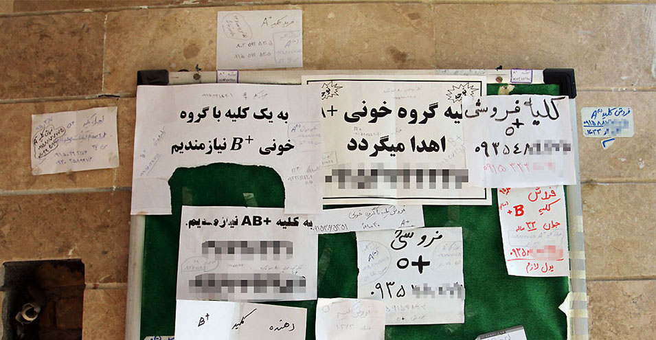 یک نماینده مجلس ایران: چه اشکالی دارد افراد نیازمند کلیه خود را بفروشند؟